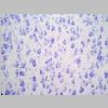 Neuronas Nissl 09.jpg